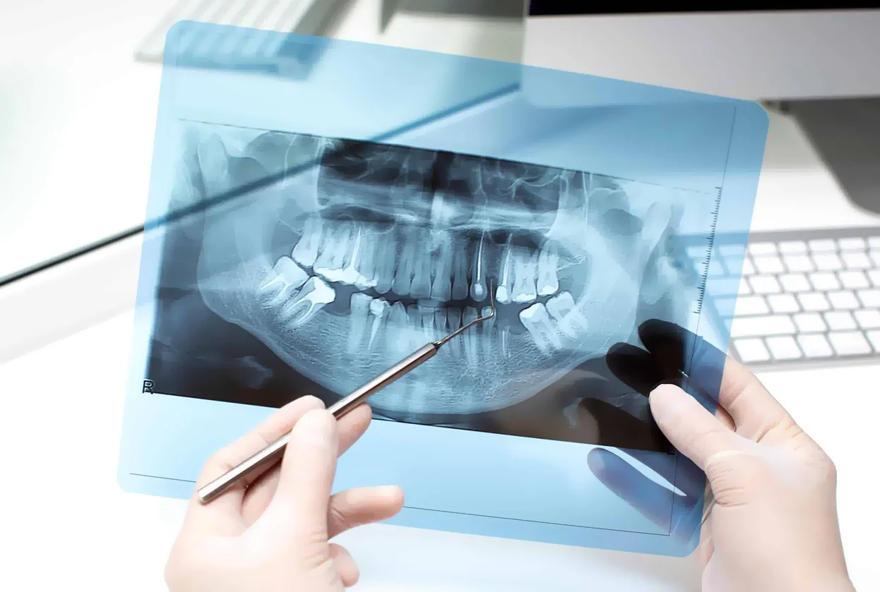 Digital Dental X-Ray